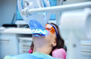 teeth whitening