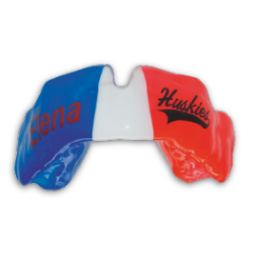🦷 Protect Your Smile with Carla Dental Ubud: The Importance of Sports Mouthguards